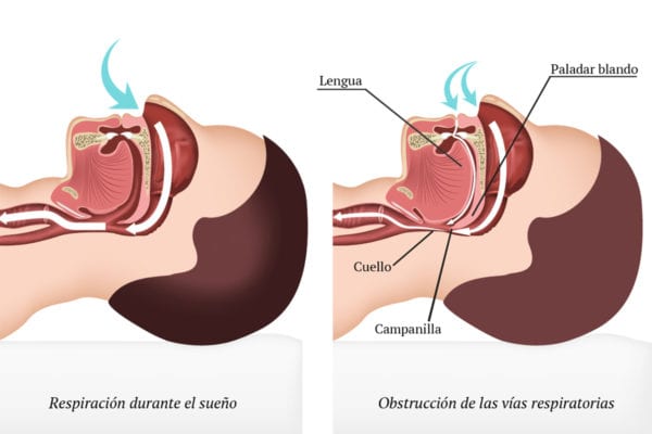 Respiracion durante el y sueño y con apnea