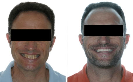 especialistas en cirugía ortognática Barcelona