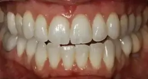 Periodoncia después