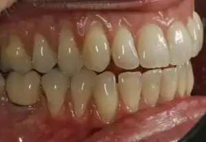 Periodoncia después