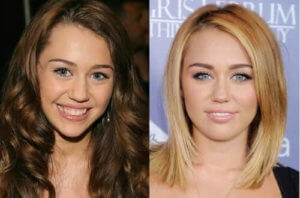 Miley Cyrus (Fuente imagen: celeb-surgery)