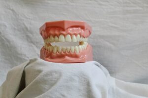 implantes dentaes