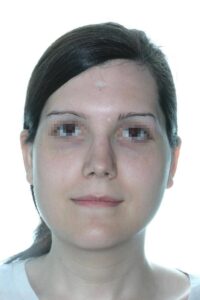 Caso Clínico Rinoplastia