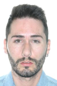 Caso Clínico Rinoplastia