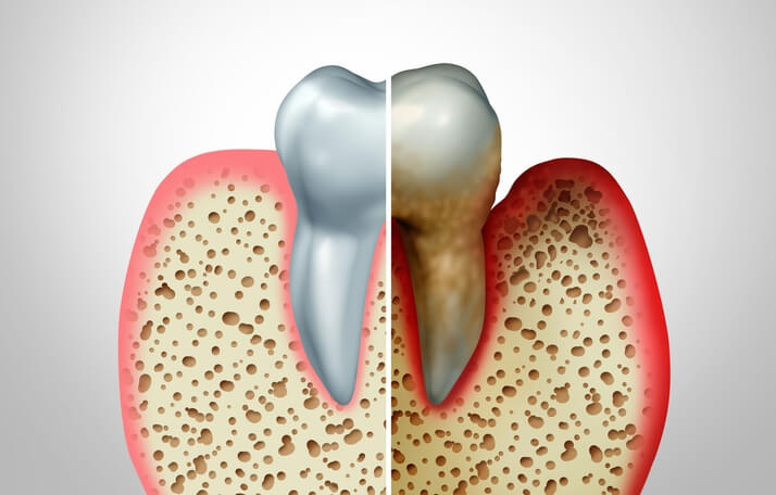 Clínica de periodoncia en Barcelona