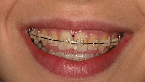 Ortodoncia Principal