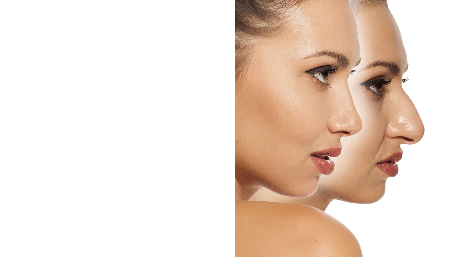 Discover Your True Beauty with Rhinoplasty: Precision, Preservation ...