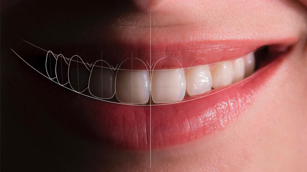 Smile design clínica dental Barcelona