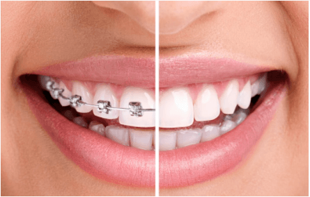 Clínica de ortodoncia en Barcelona