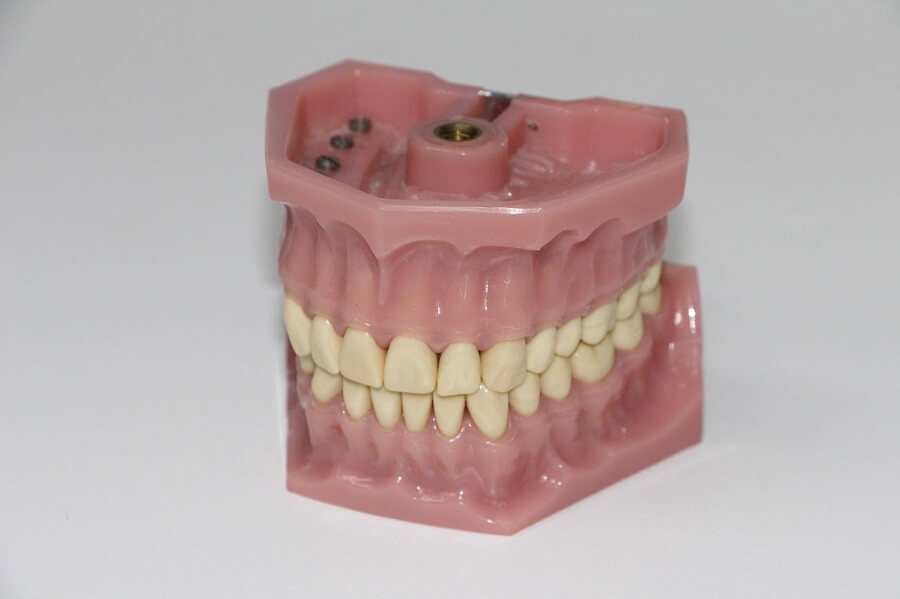 Prótesis dentales en Barcelona