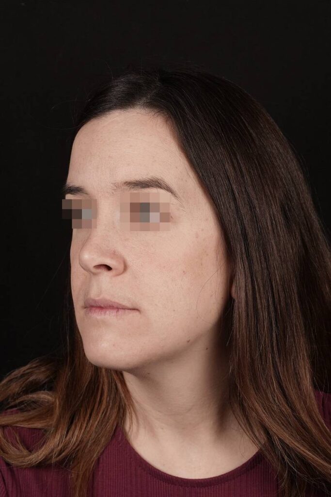 caso clínico de ortognática