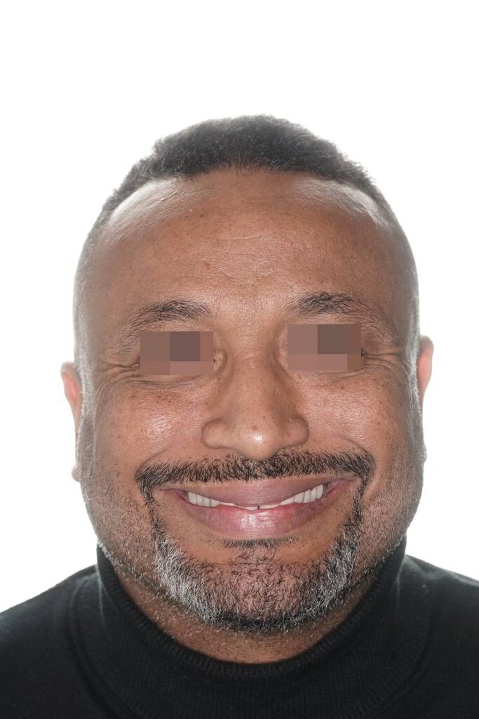 Caso clínico Ortognática