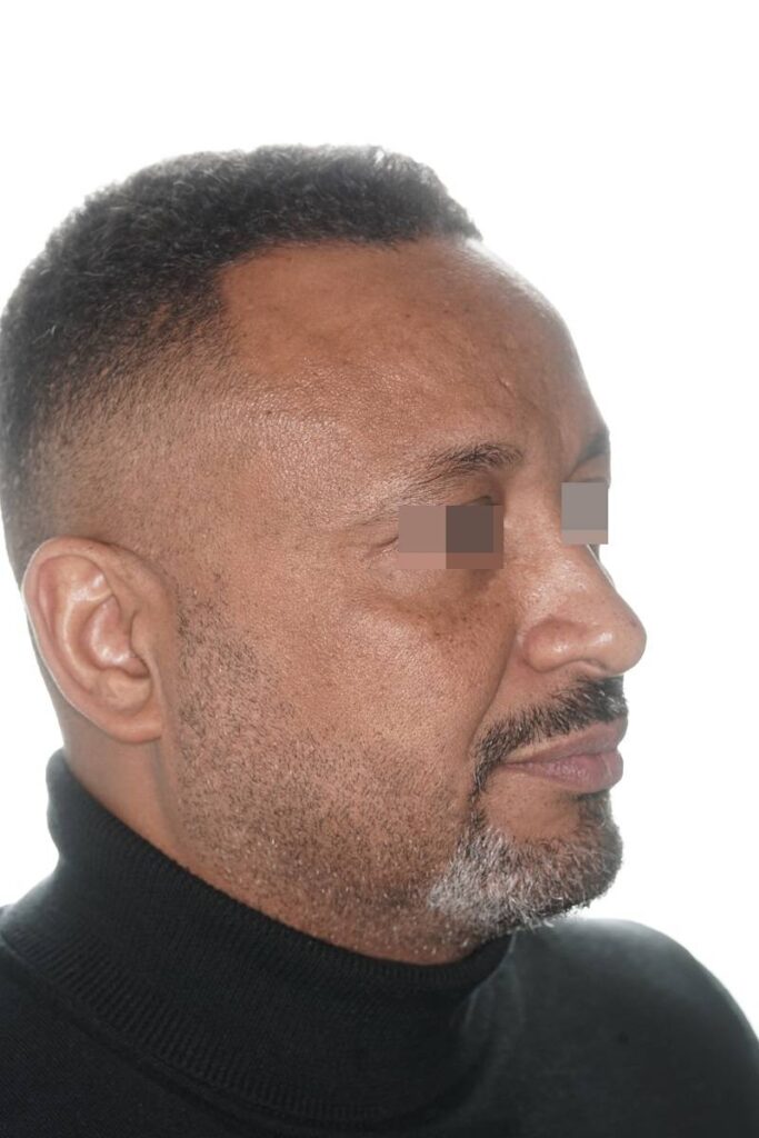 Caso clínico Ortognática