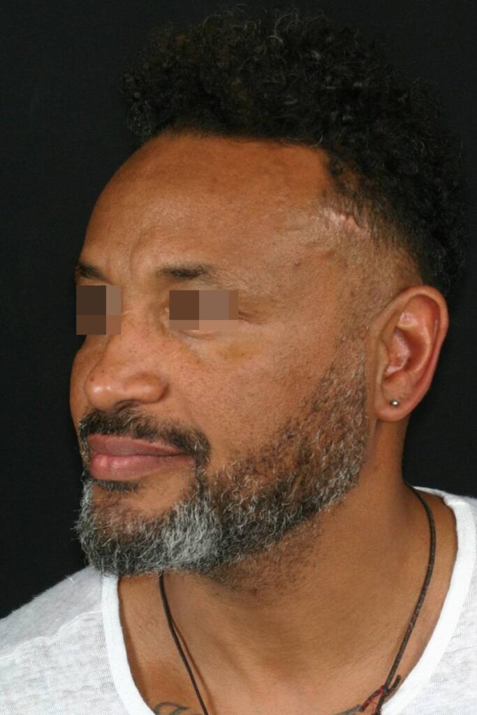 Caso clínico Ortognática