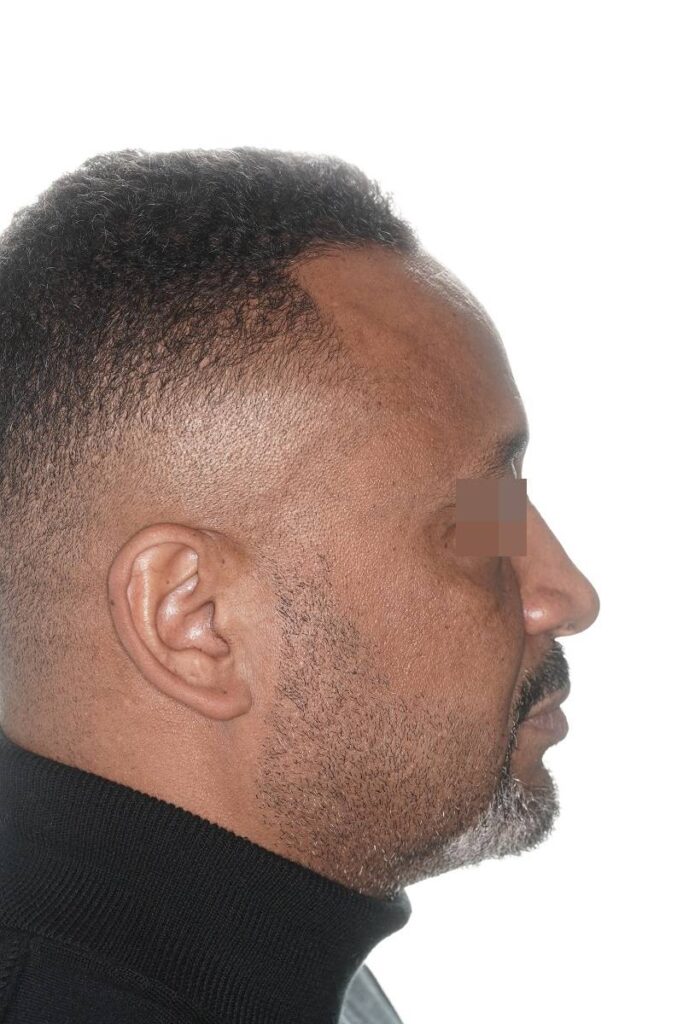 Caso clínico Ortognática