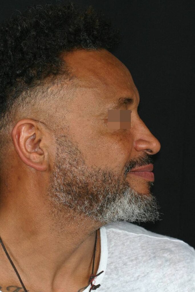 Caso clínico Ortognática