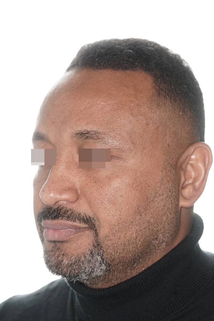 Caso clínico Ortognática