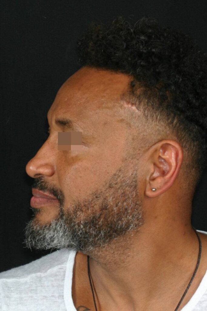 Caso clínico Ortognática