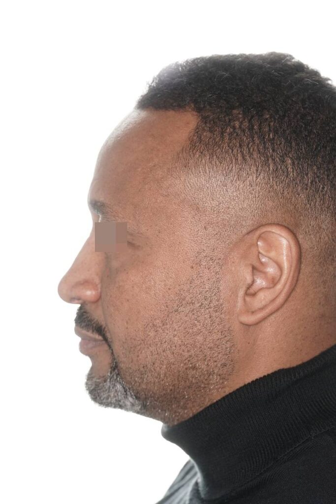 Caso clínico Ortognática