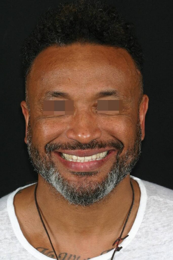 Caso clínico Ortognática