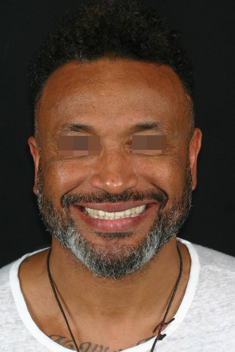 Caso clínico Ortognática