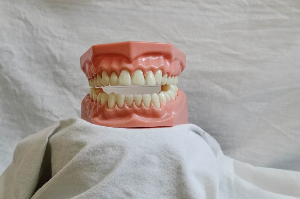 implantes dentaes